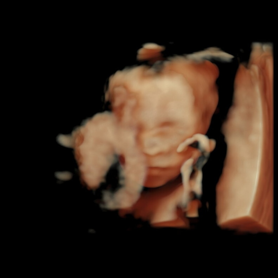 Photo shared by Emily for their Babylist baby registry.
