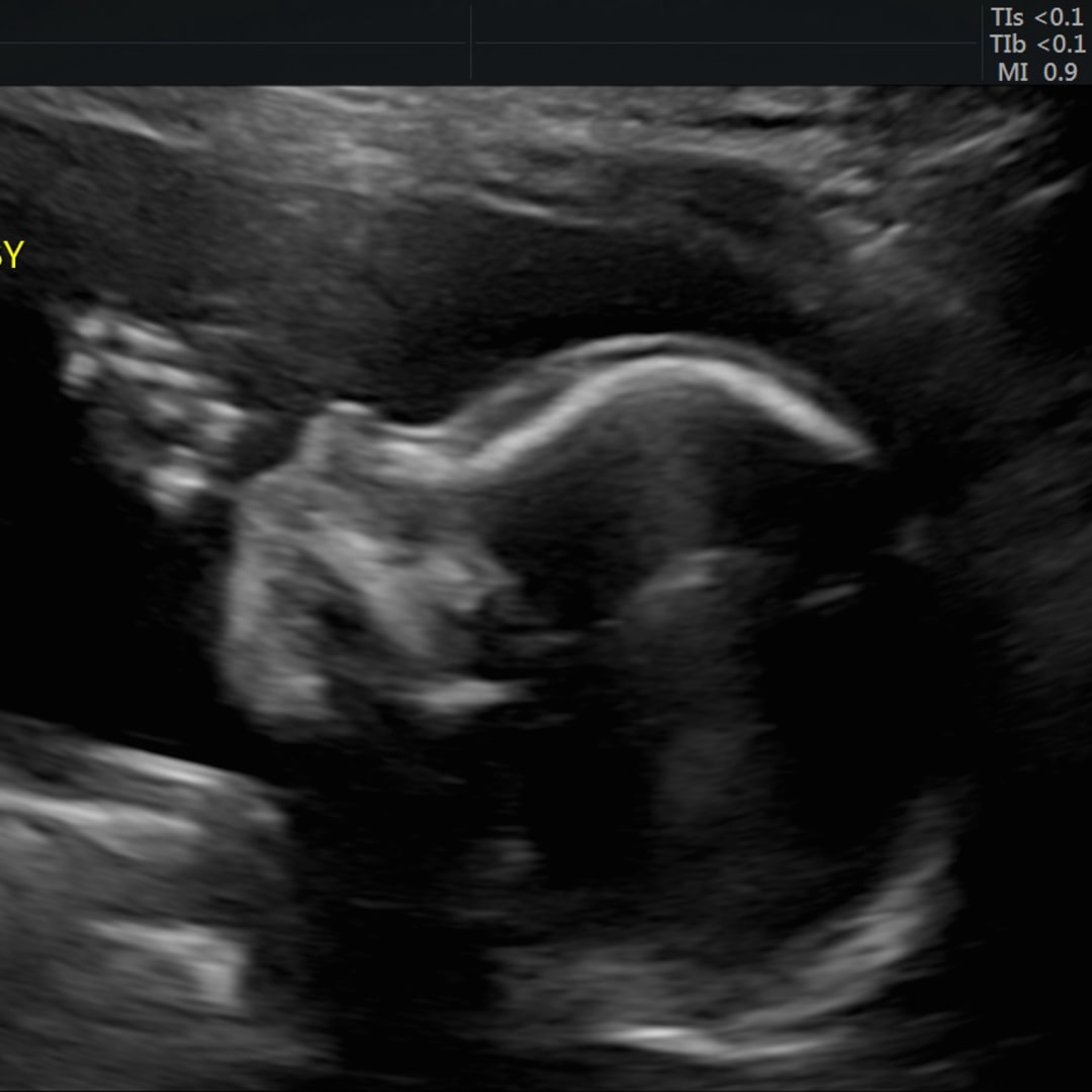 Photo shared by Taylor for their Babylist baby registry.