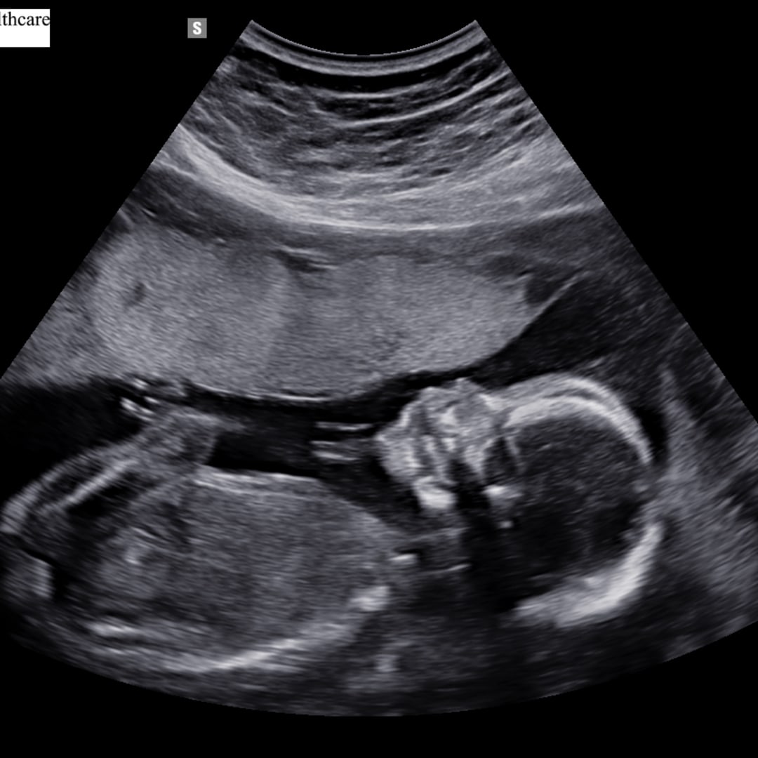 Photo shared by Sarah for their Babylist baby registry.