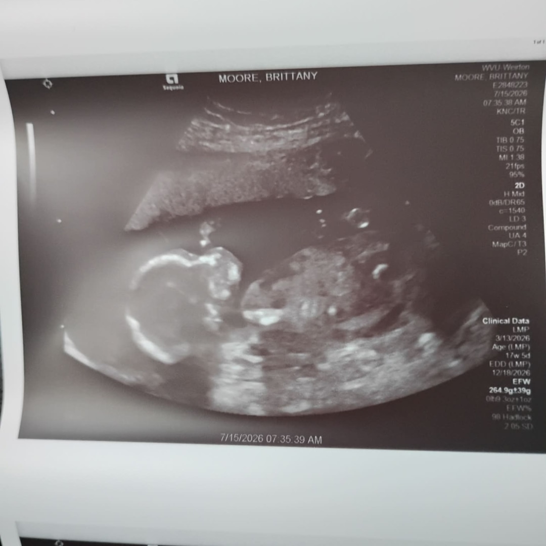 Photo shared by Brittany for their Babylist baby registry.