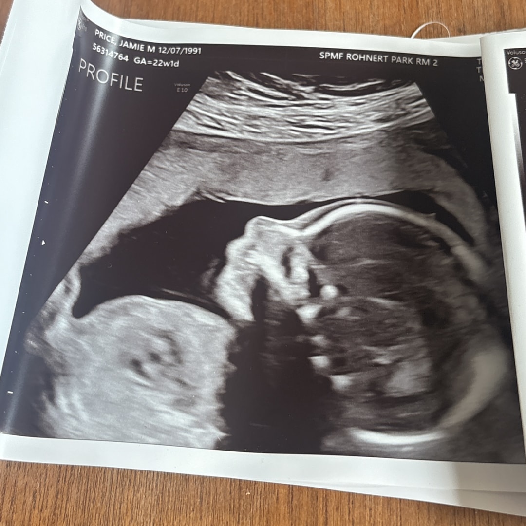 Photo shared by Jamie for their Babylist baby registry.