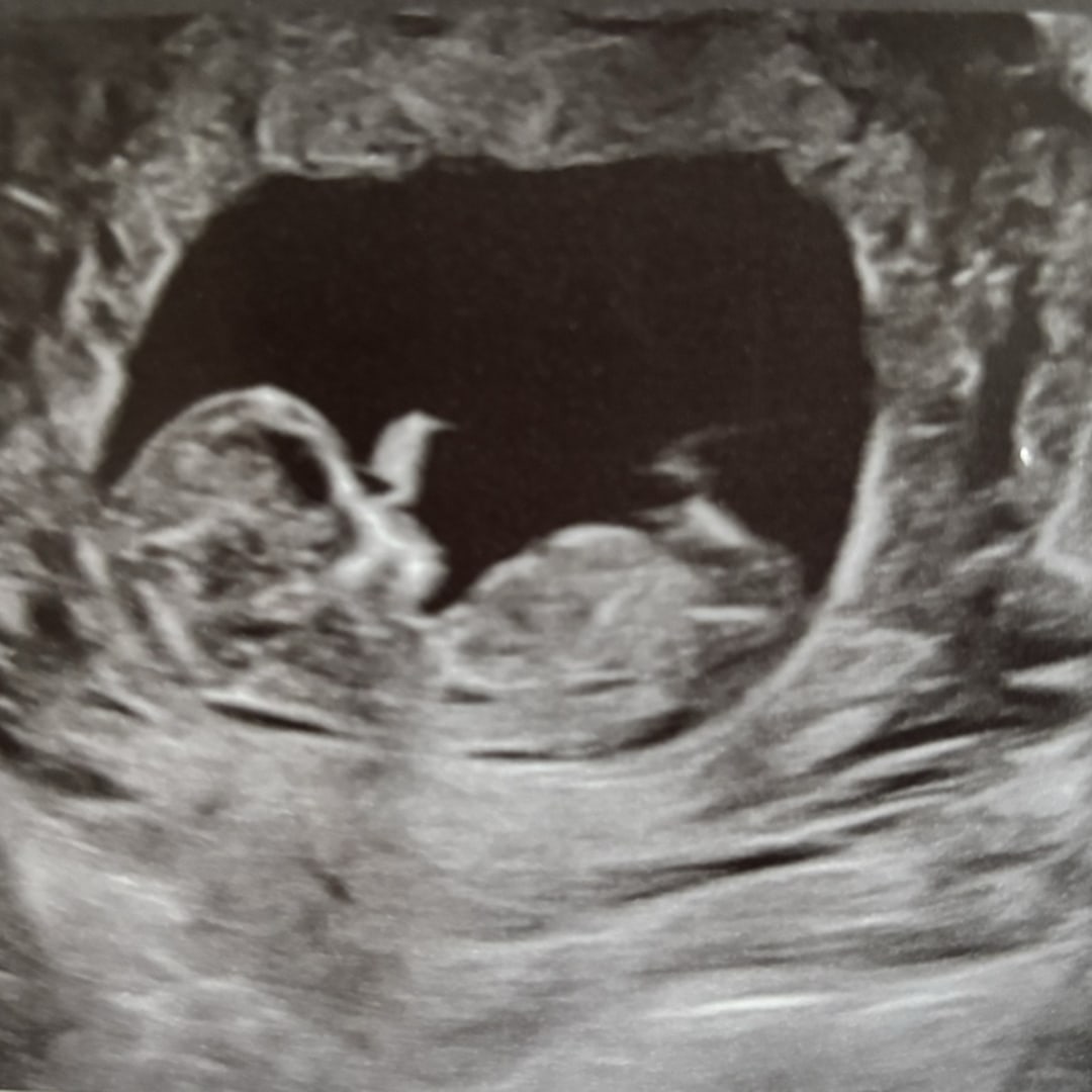 Photo shared by Dannyn for their Babylist baby registry.