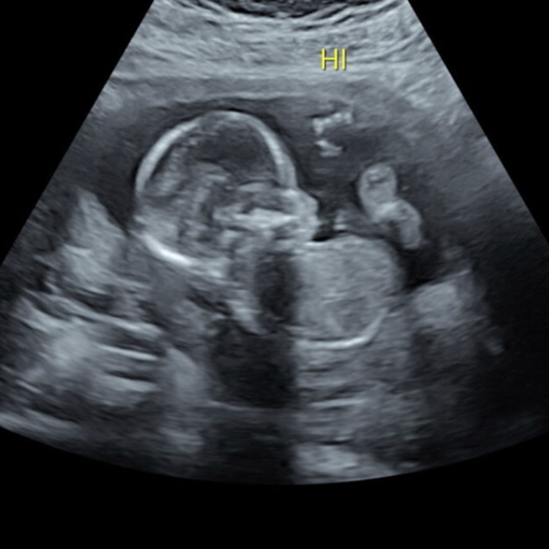 Photo shared by Abigail for their Babylist baby registry.