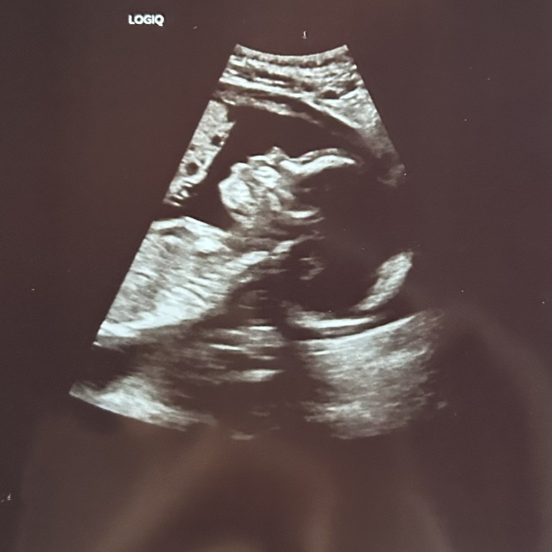 Photo shared by Eliana for their Babylist baby registry.