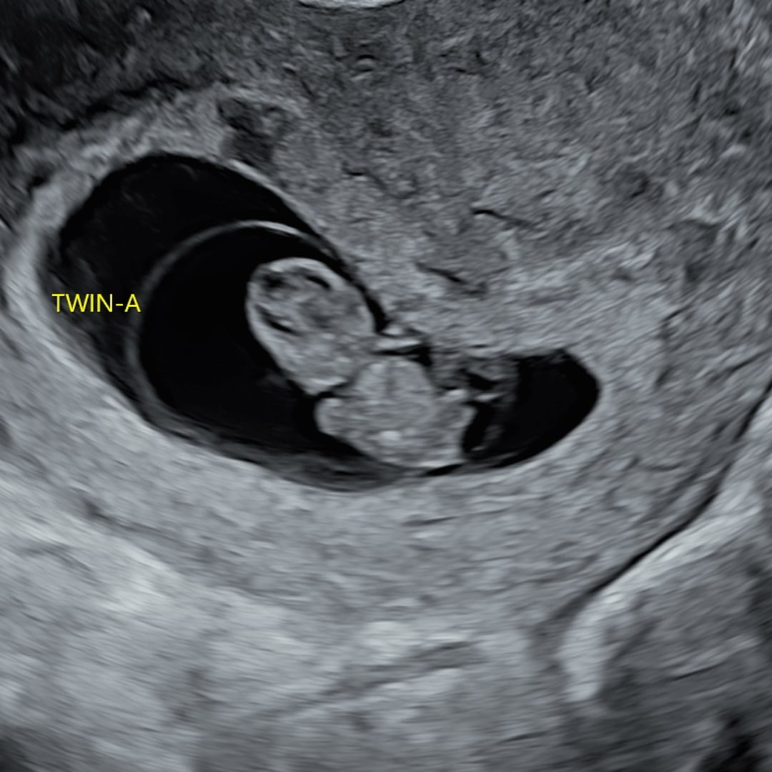 Photo shared by Holly for their Babylist baby registry.