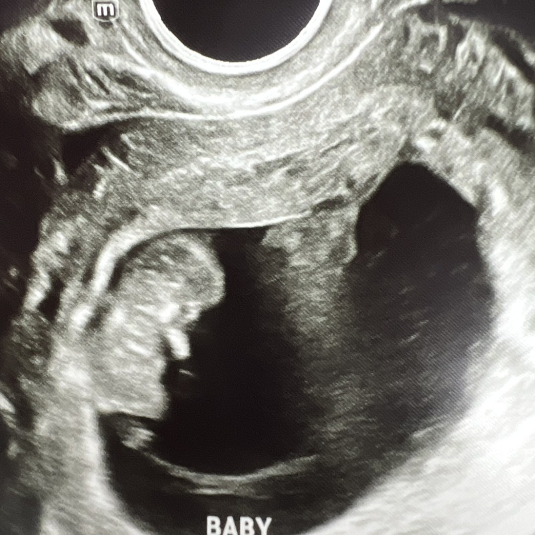 Photo shared by Jamie for their Babylist baby registry.