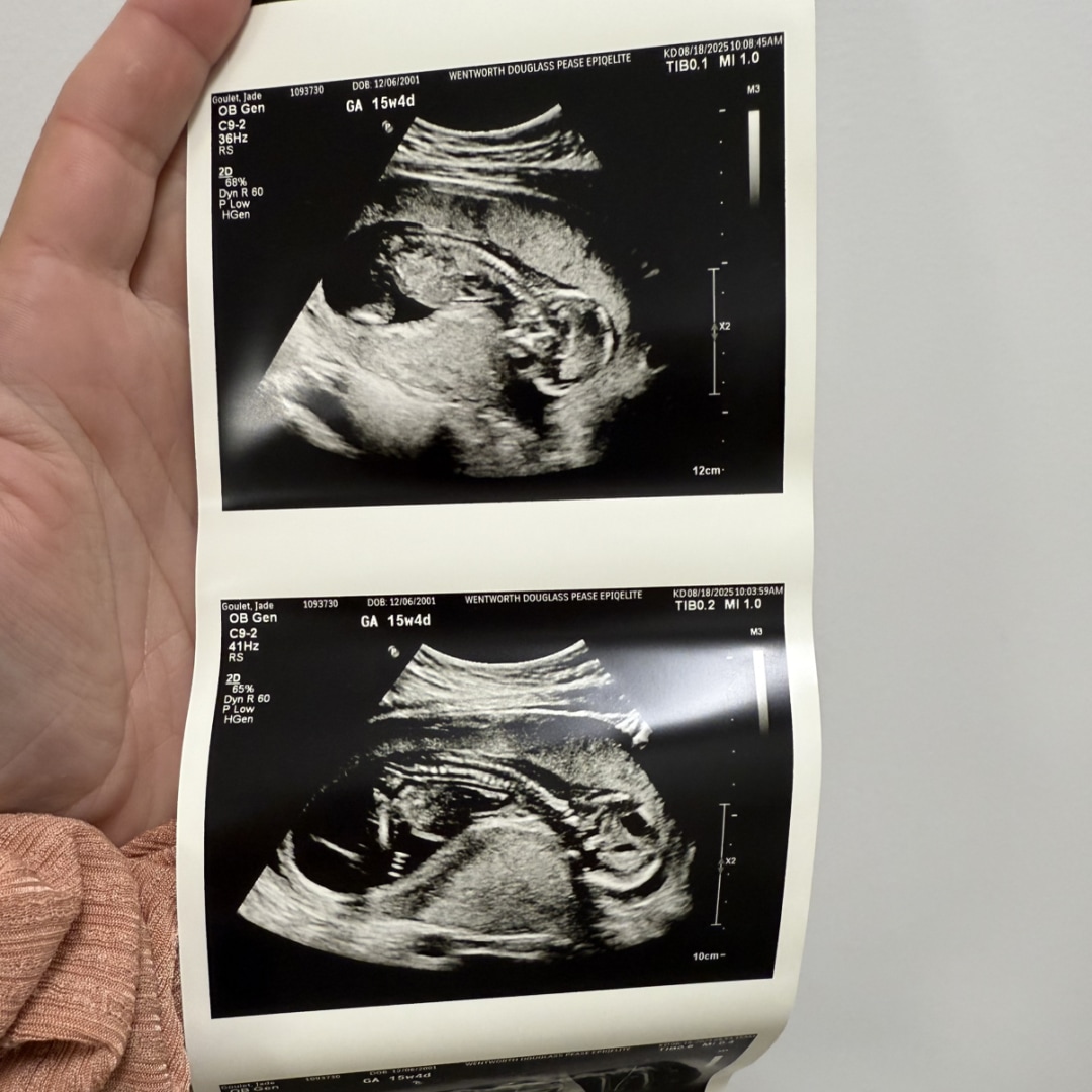 Photo shared by Jade for their Babylist baby registry.