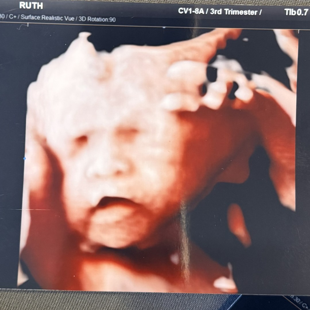 Photo shared by Ruth for their Babylist baby registry.