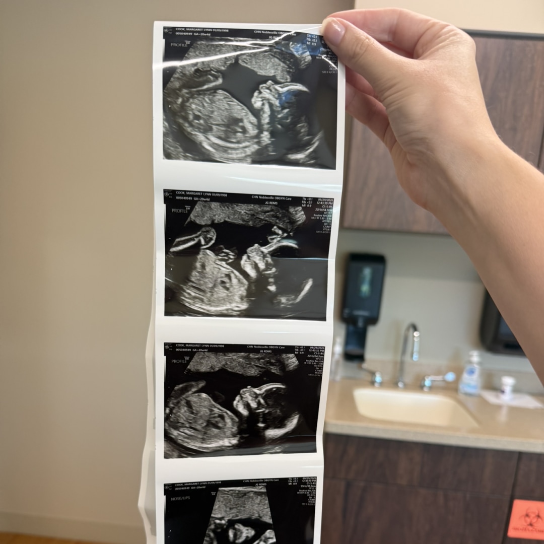 Photo shared by Margo for their Babylist baby registry.