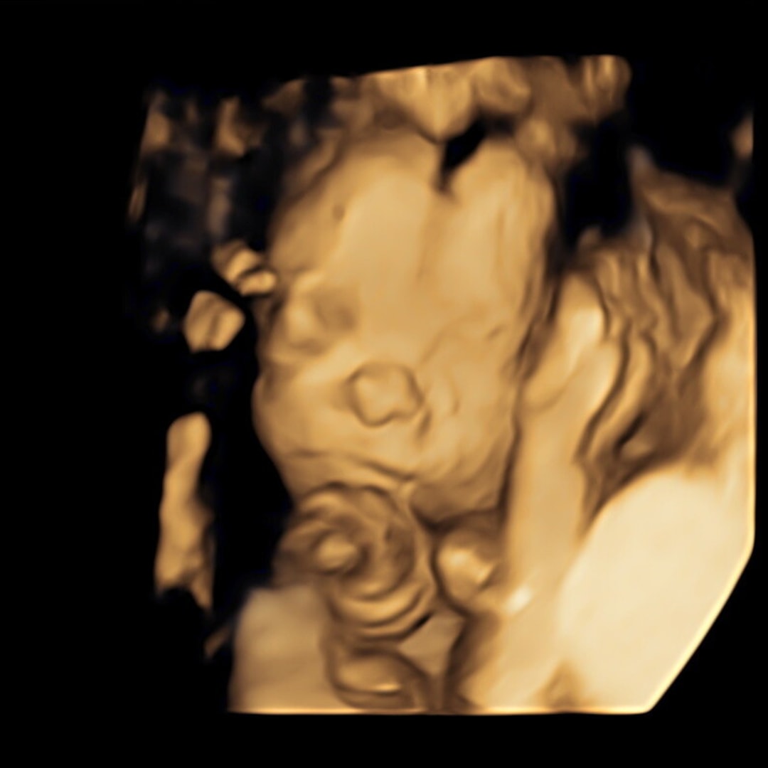 Photo shared by Victoria for their Babylist baby registry.