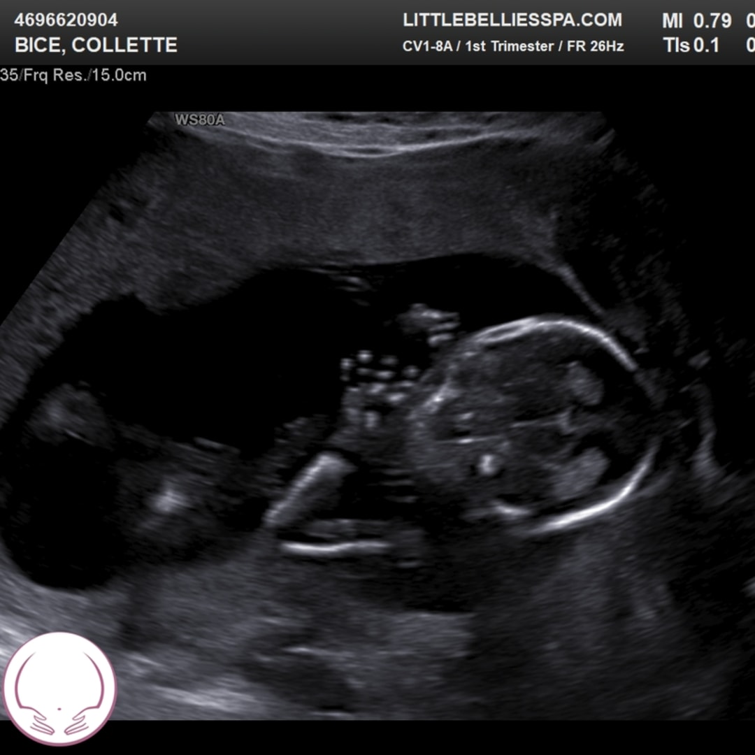 Photo shared by Collette for their Babylist baby registry.