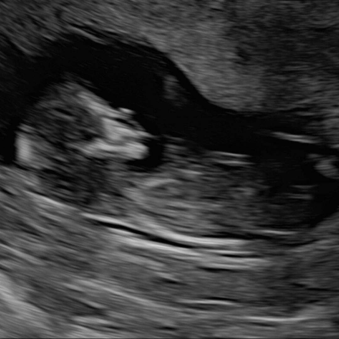 Photo shared by Jessica for their Babylist baby registry.