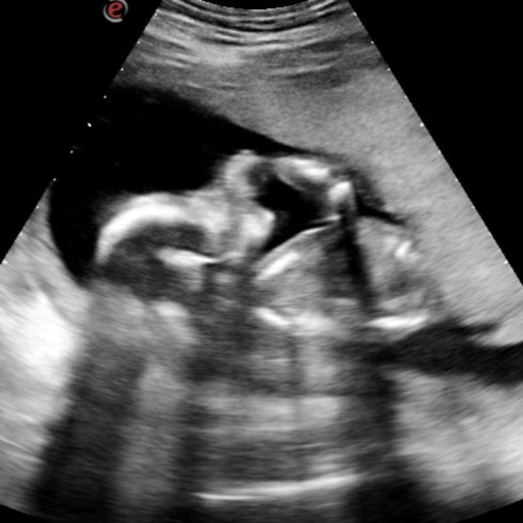 Photo shared by Alexis for their Babylist baby registry.