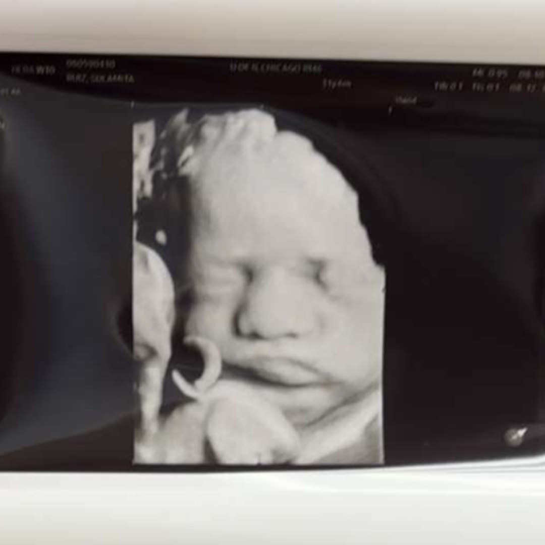 Photo shared by Sulamita for their Babylist baby registry.