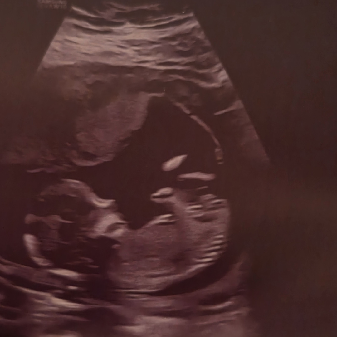 Photo shared by Madeleine for their Babylist baby registry.