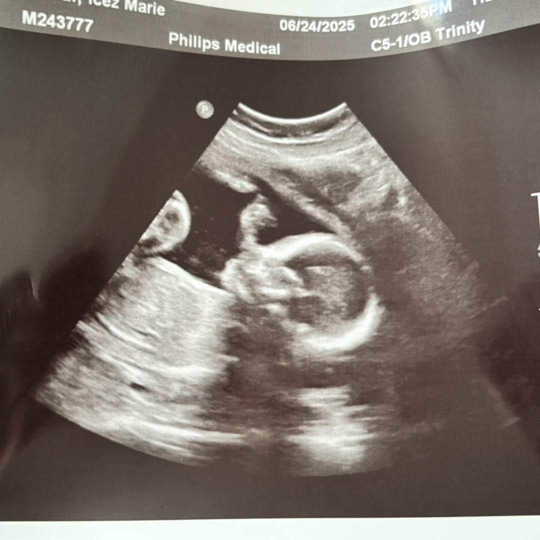 Photo shared by Icez for their Babylist baby registry.