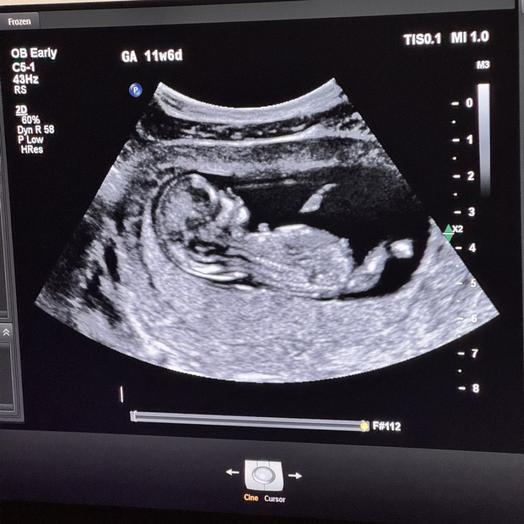 Photo shared by Courtney for their Babylist baby registry.