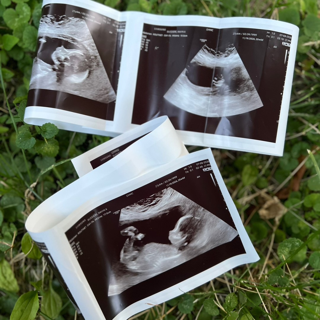 Photo shared by Ravin for their Babylist baby registry.