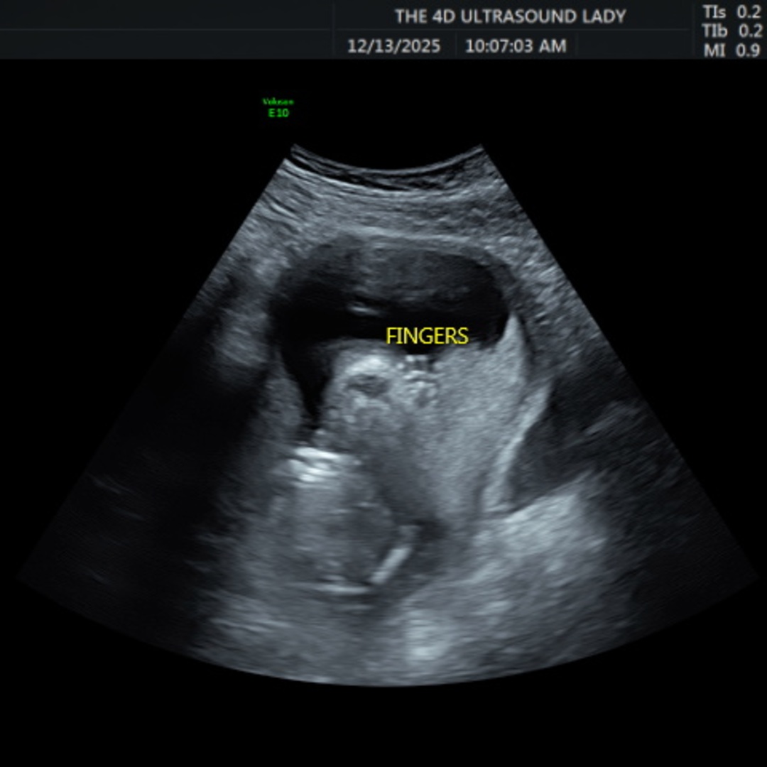 Photo shared by Kaysy for their Babylist baby registry.