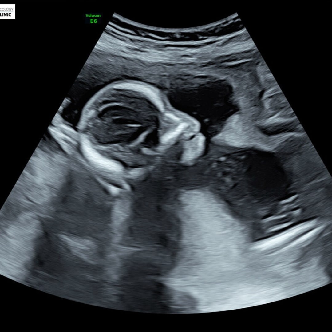 Photo shared by Lauren and Nate for their Babylist baby registry.