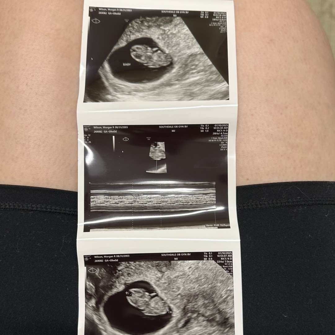 Photo shared by Morgan for their Babylist baby registry.