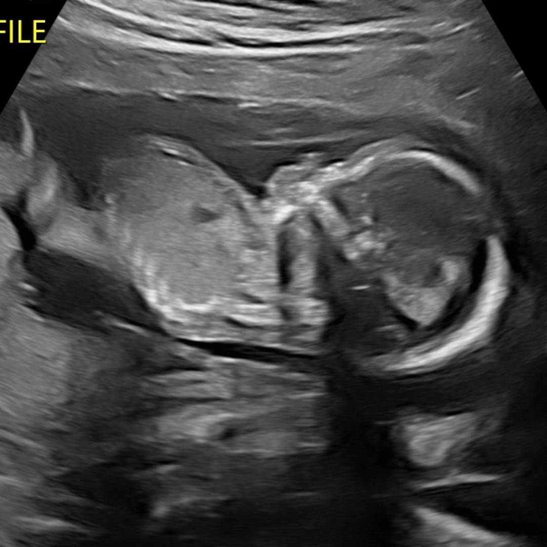 Photo shared by Kandice for their Babylist baby registry.