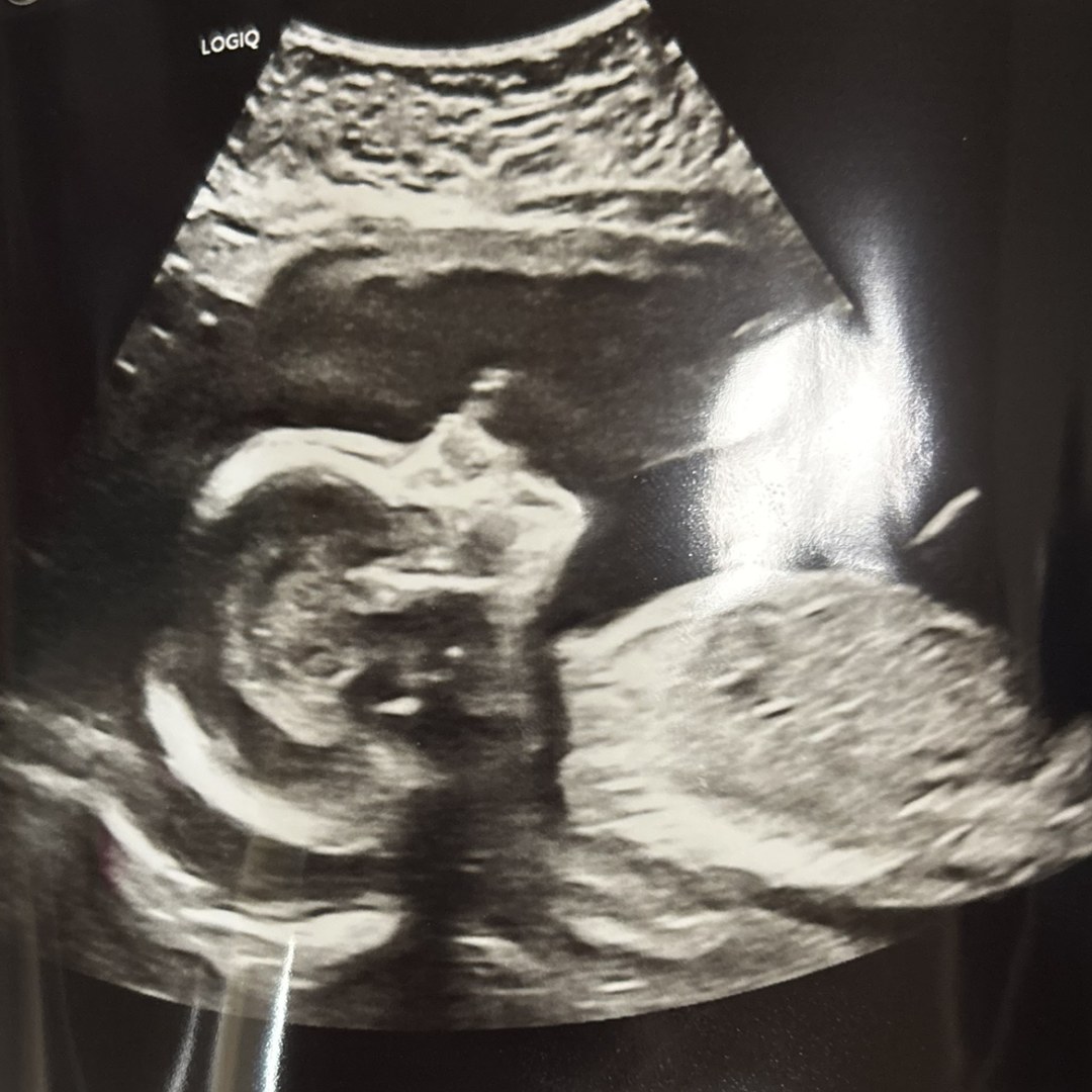 Photo shared by Alissa for their Babylist baby registry.