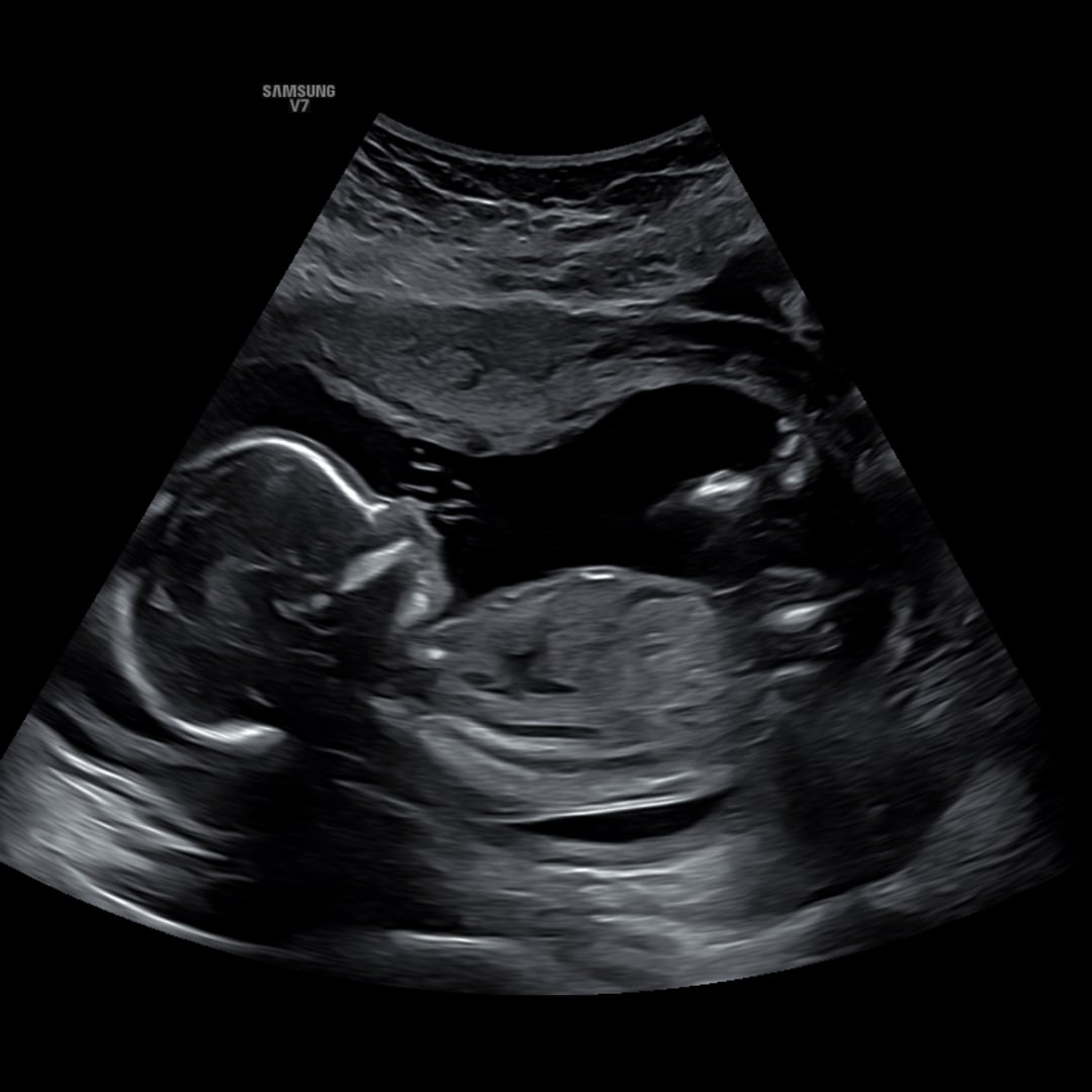 Photo shared by Aina for their Babylist baby registry.