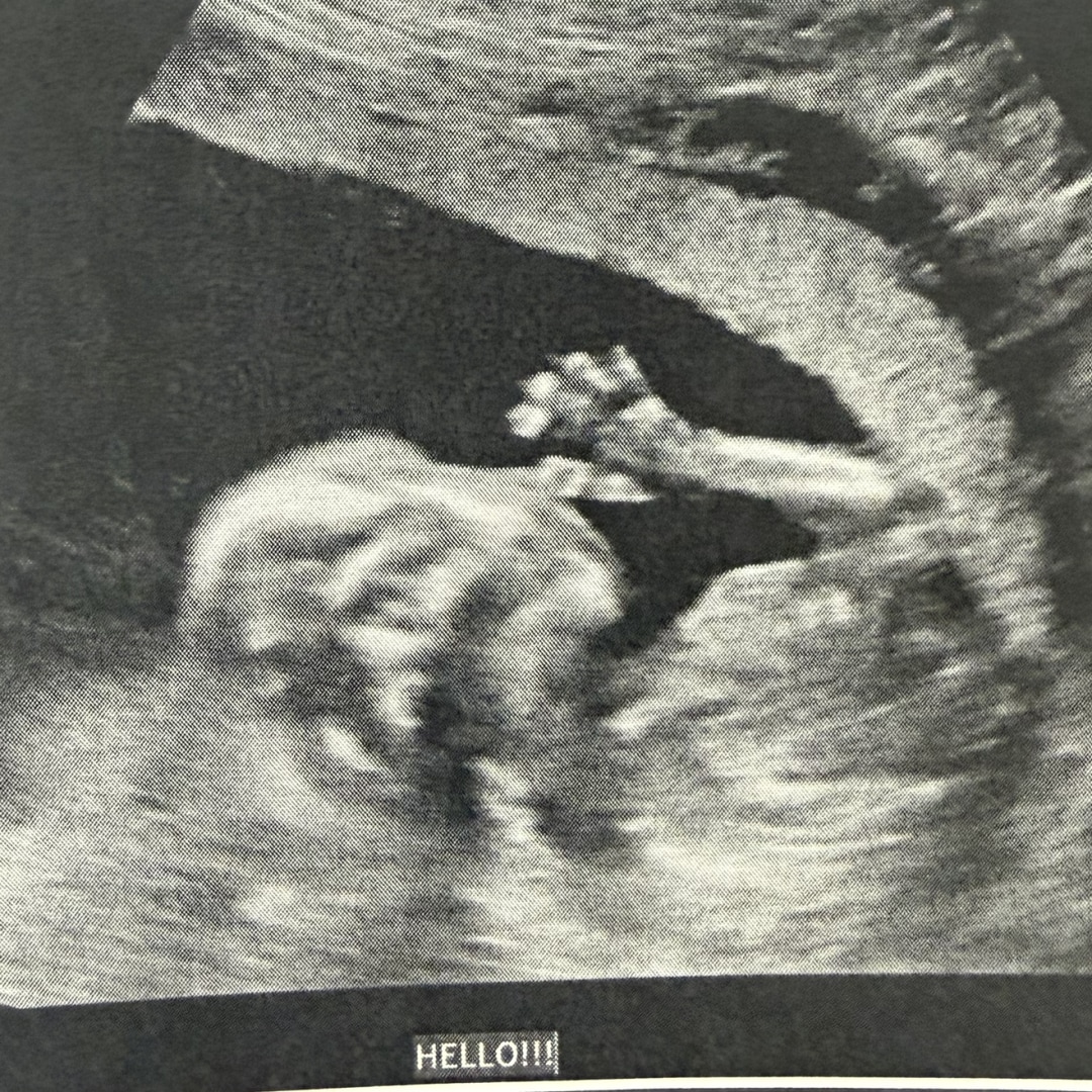 Photo shared by Carolina for their Babylist baby registry.