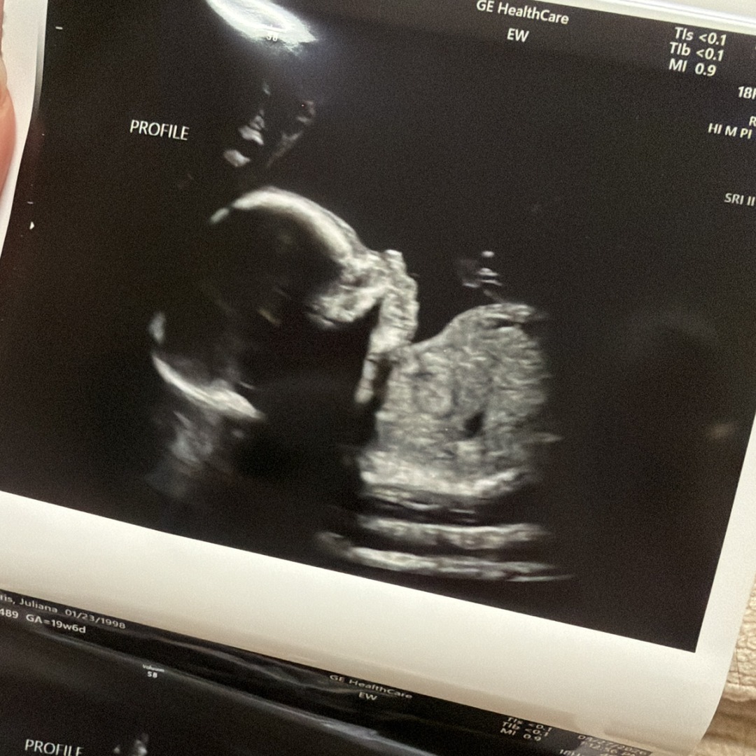 Photo shared by Juliana for their Babylist baby registry.