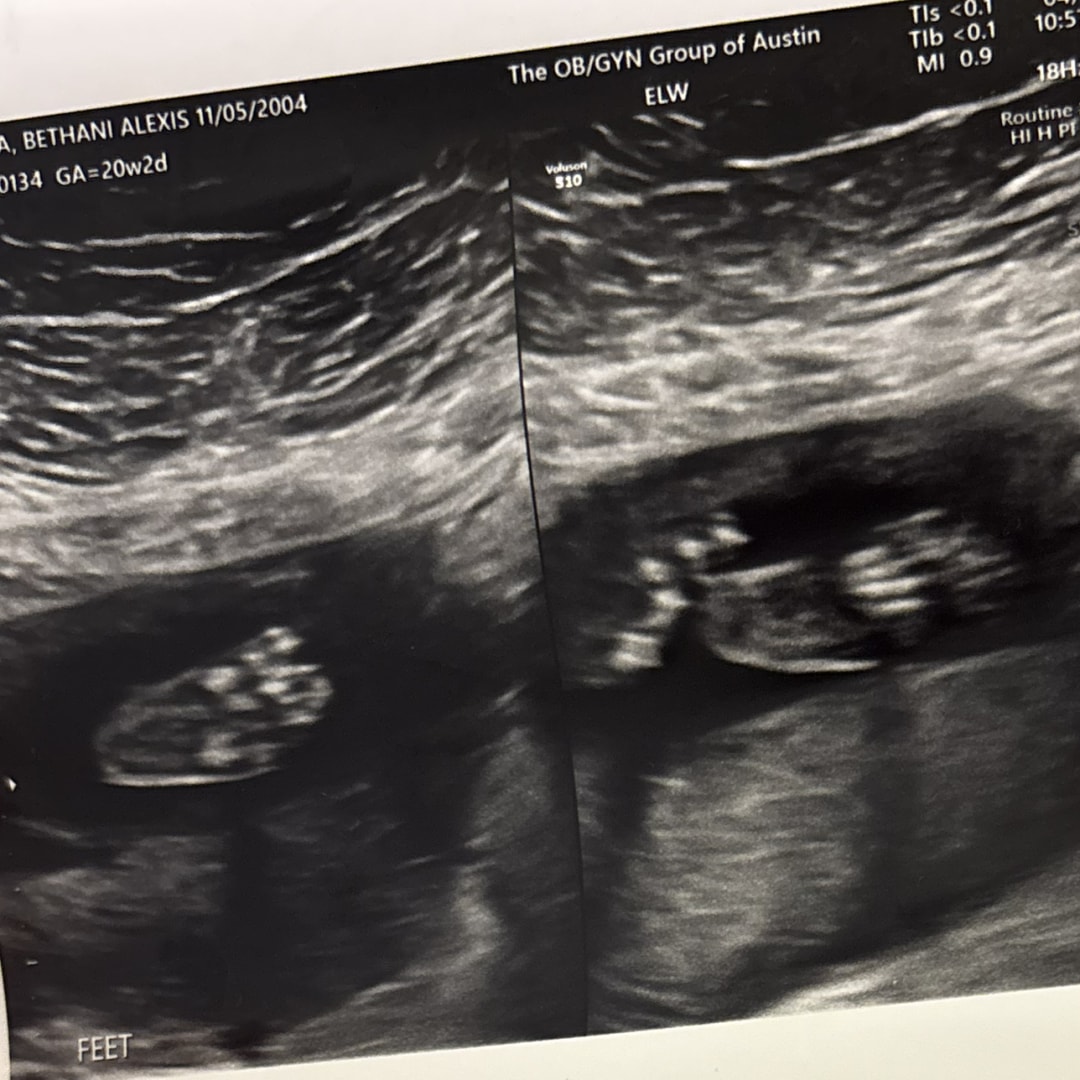 Photo shared by Bethani for their Babylist baby registry.