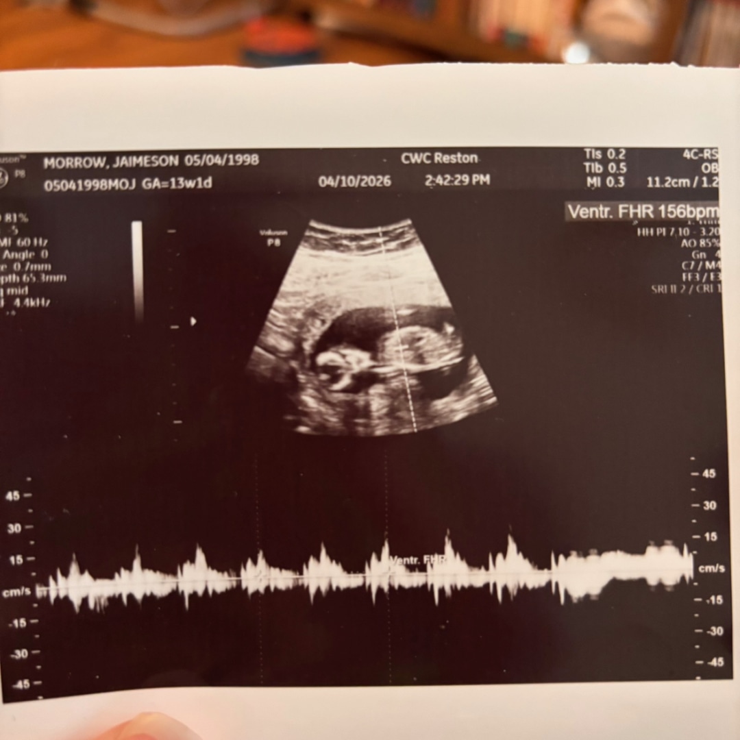Photo shared by Jaime for their Babylist baby registry.