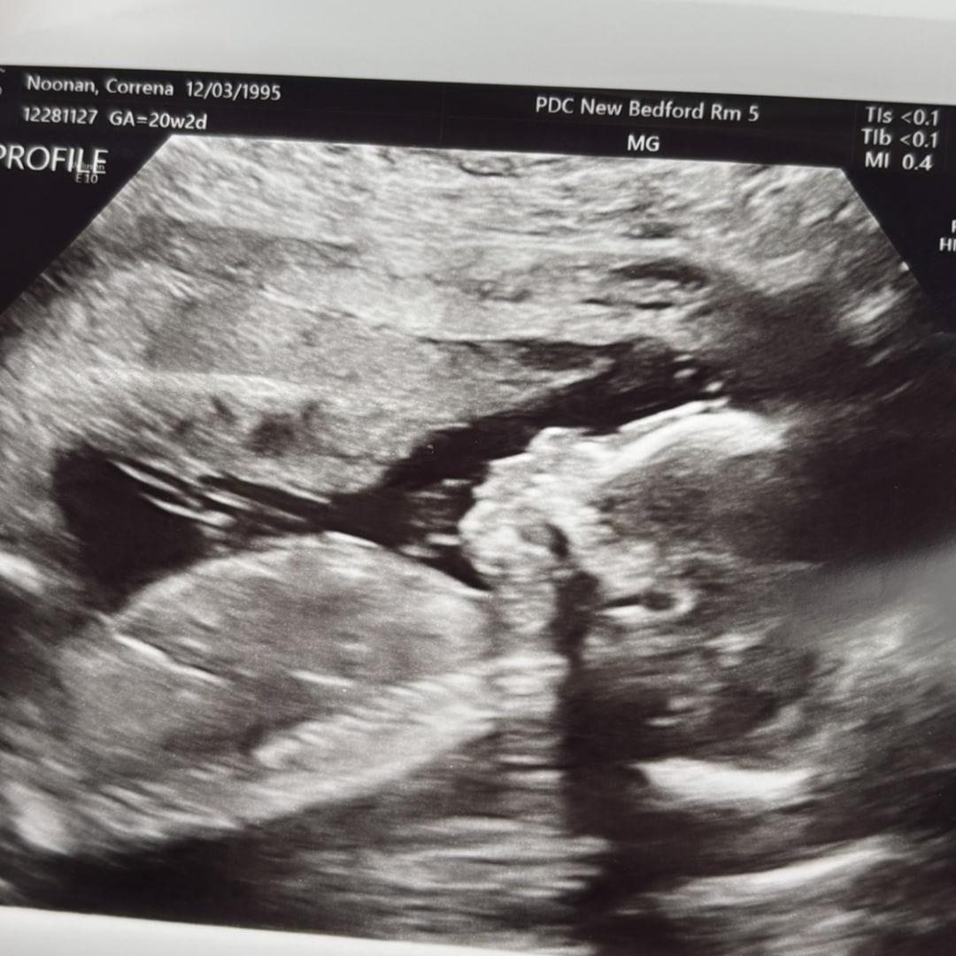 Photo shared by Correna for their Babylist baby registry.