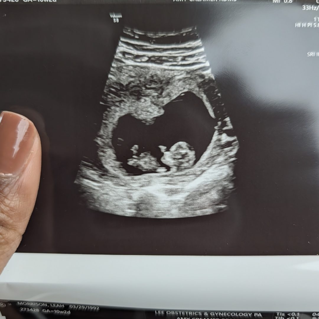 Photo shared by Leah for their Babylist baby registry.