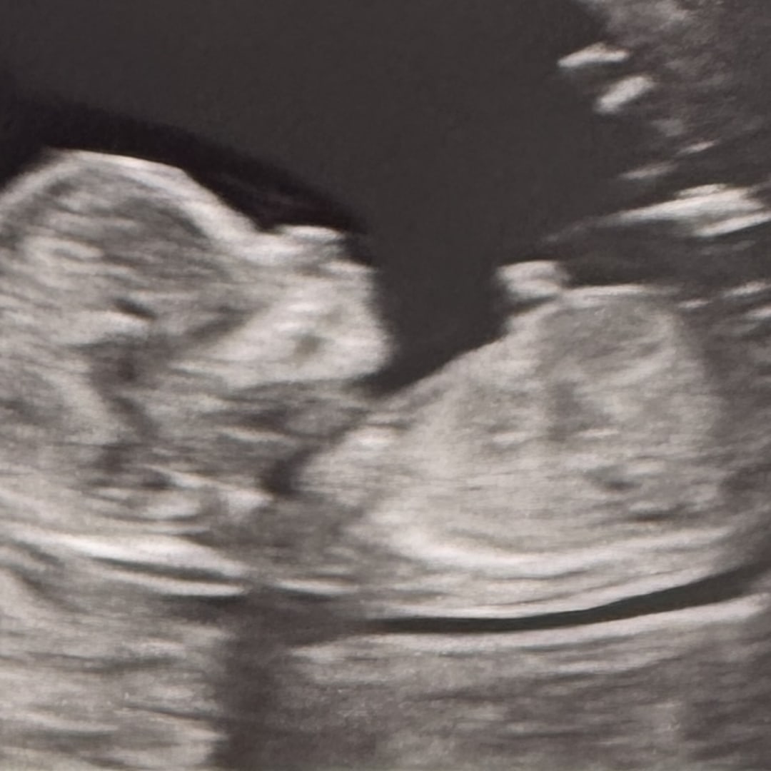 Photo shared by Jenny for their Babylist baby registry.
