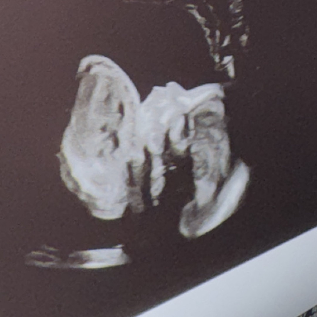 Photo shared by Joanna for their Babylist baby registry.