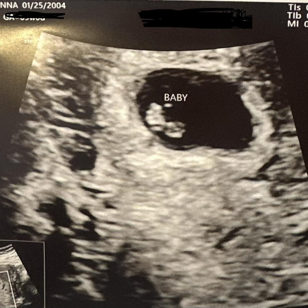 Photo shared by Anna for their Babylist baby registry.