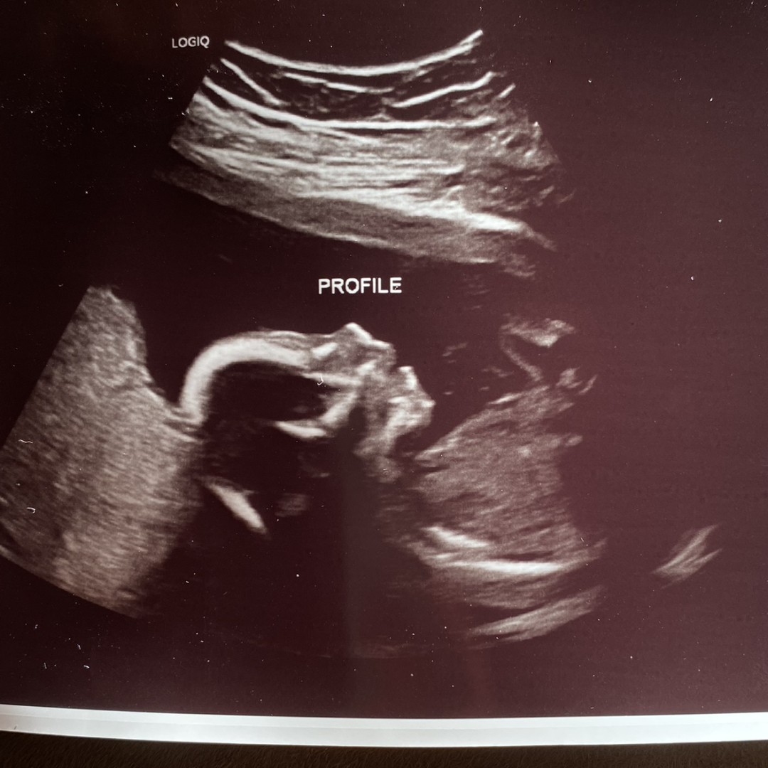 Photo shared by Abigail for their Babylist baby registry.