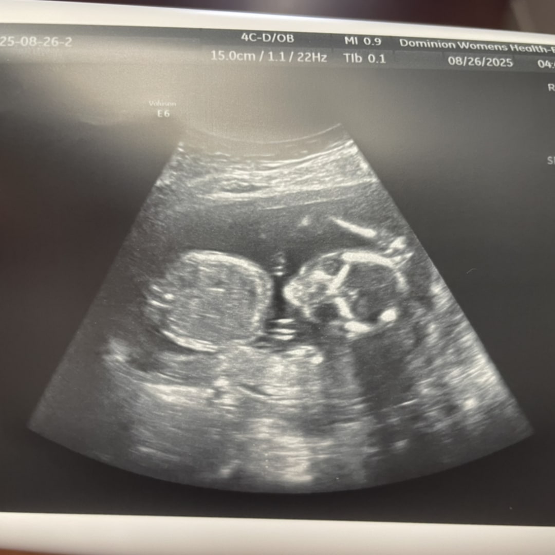 Photo shared by Emily for their Babylist baby registry.