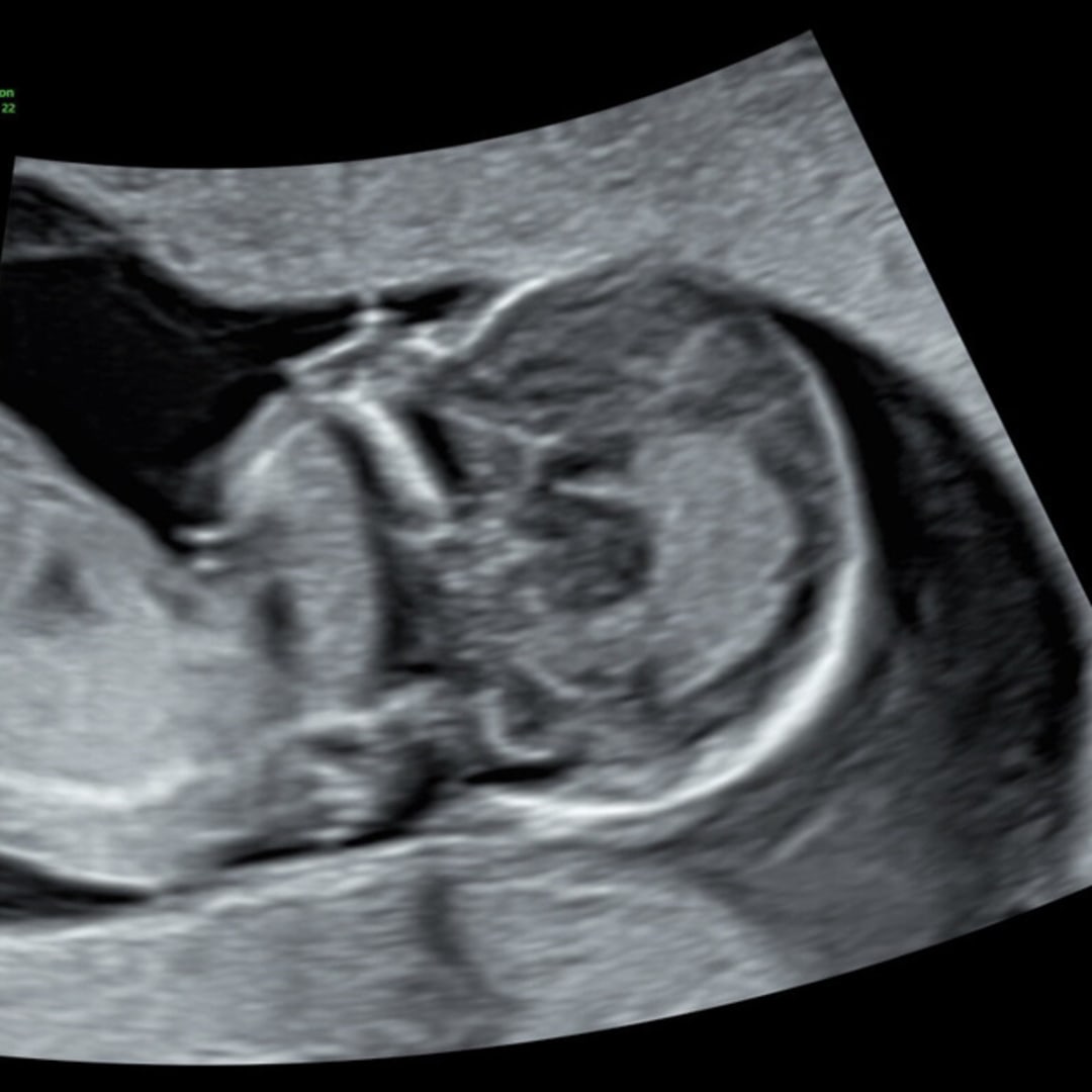 Photo shared by Stephanie for their Babylist baby registry.