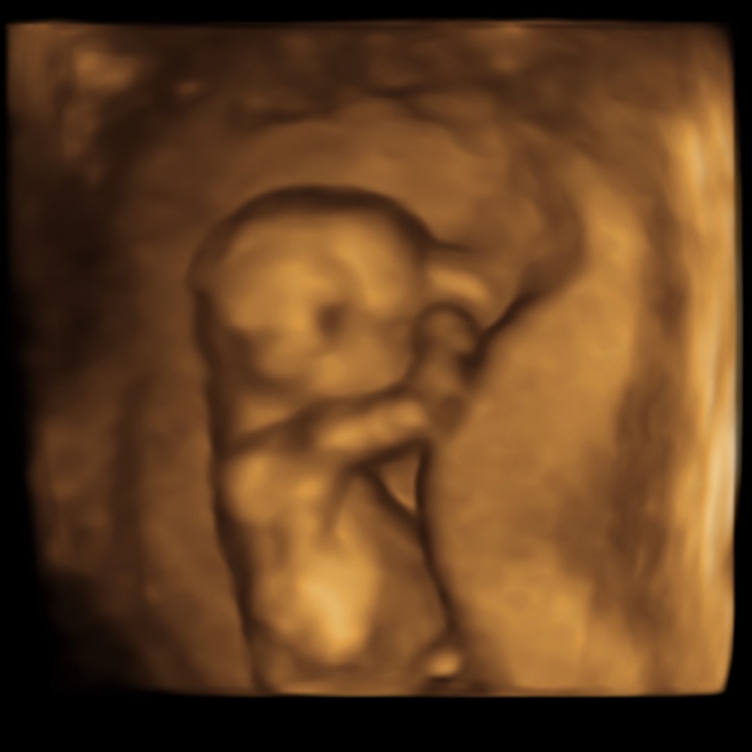 Photo shared by Angelina for their Babylist baby registry.