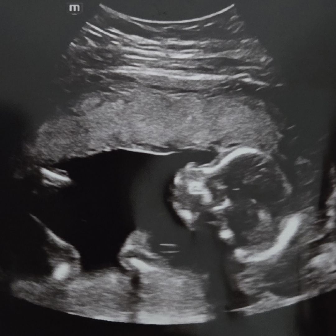 Photo shared by Amber for their Babylist baby registry.