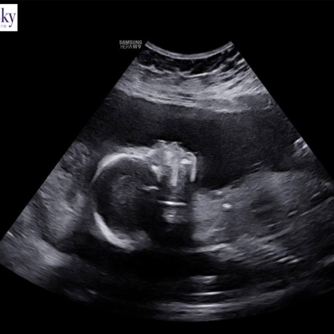 Photo shared by Mariah for their Babylist baby registry.