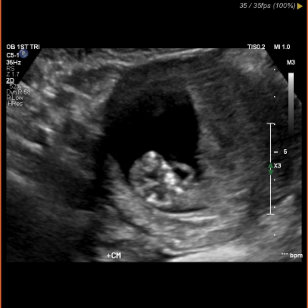 Photo shared by Dayna for their Babylist baby registry.