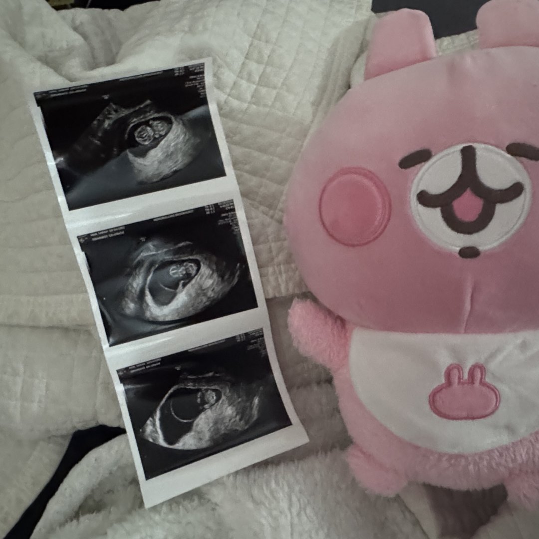 Photo shared by Sarah for their Babylist baby registry.