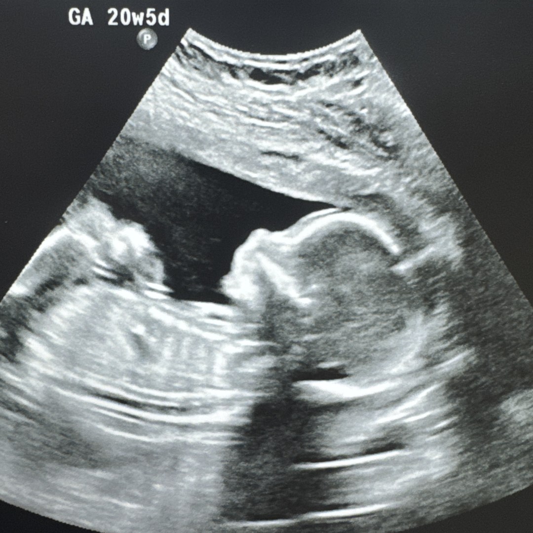 Photo shared by Courtney for their Babylist baby registry.