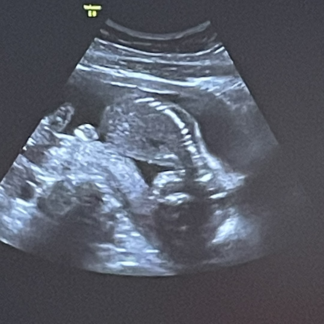 Photo shared by Airele for their Babylist baby registry.