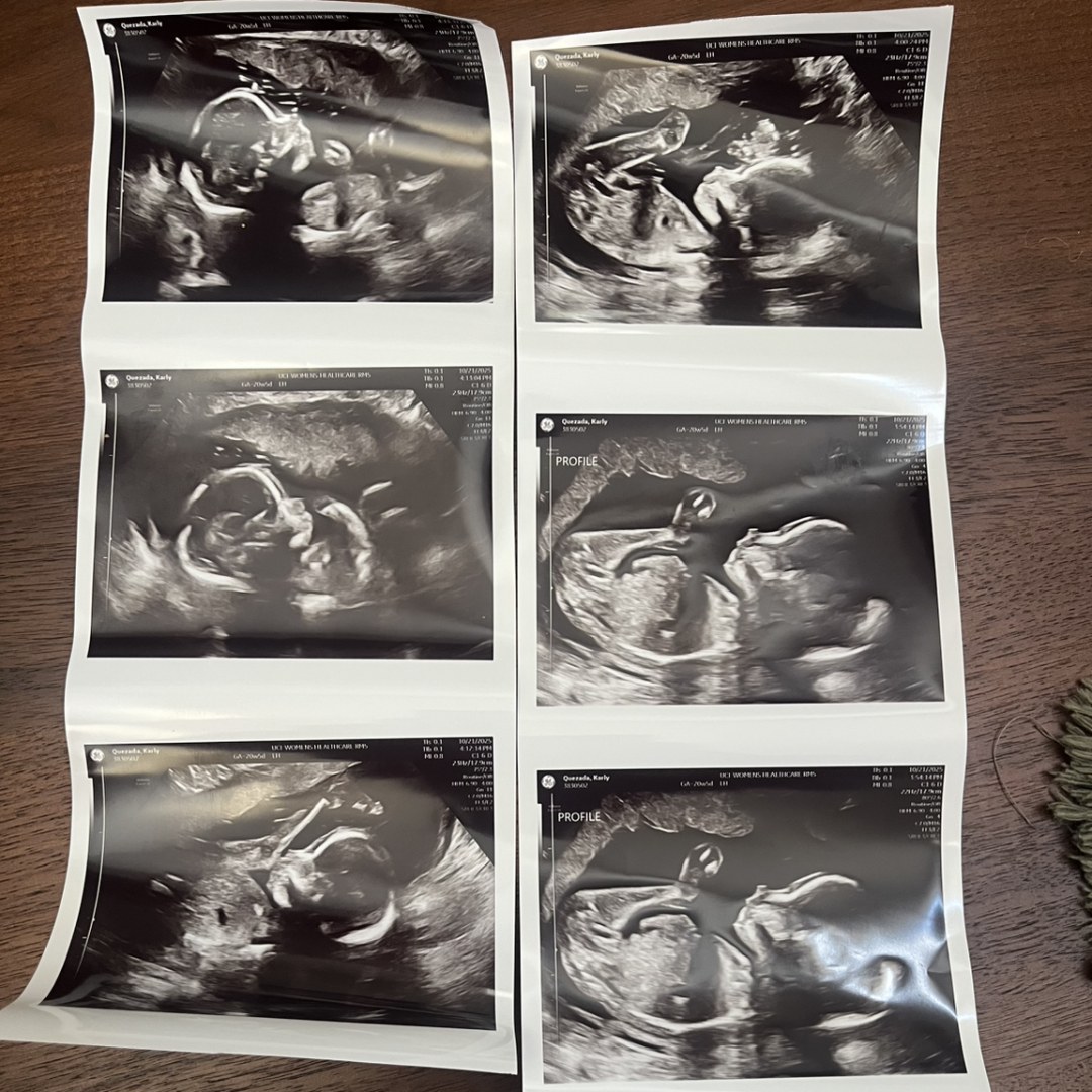 Photo shared by Karly for their Babylist baby registry.