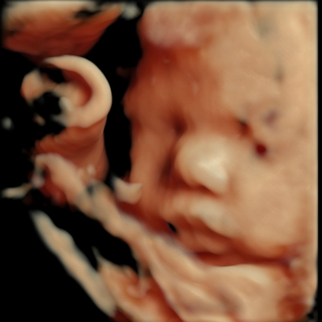 Photo shared by Kassi for their Babylist baby registry.