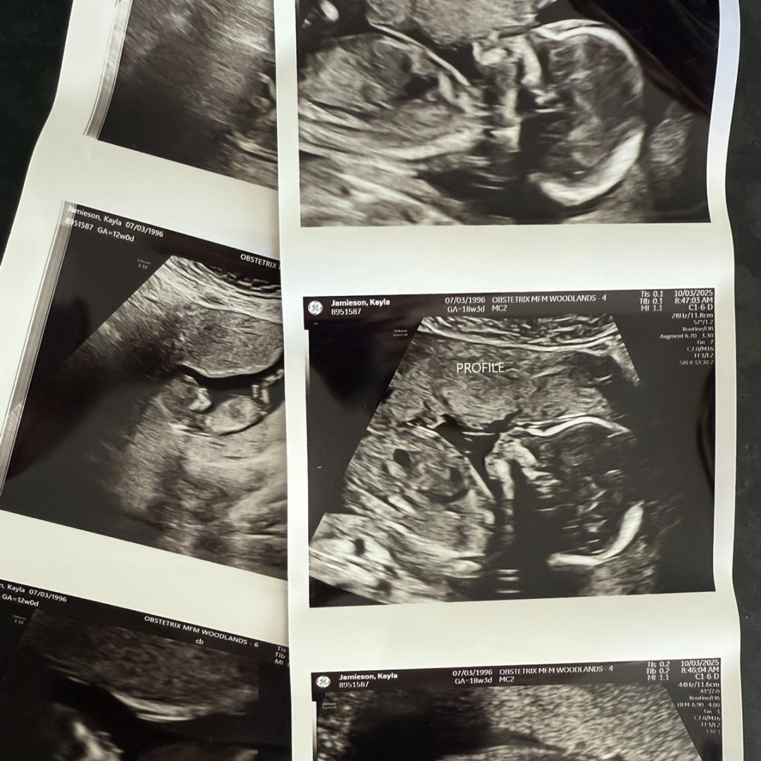 Photo shared by Kayla for their Babylist baby registry.